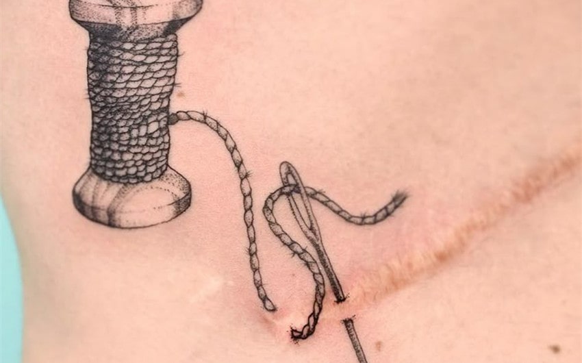 tattoo over scar ideas